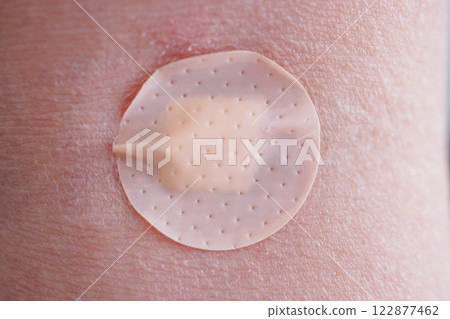 Round adhesive plaster on man arm close up Round adhesive plaster on man arm close up 122877462