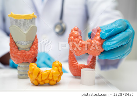 Hyperthyroidism, Overactive Thyroid, Thyroid Lymphoma, Asian doctor with thyroid gland human anatomy model in hospital. 122878455
