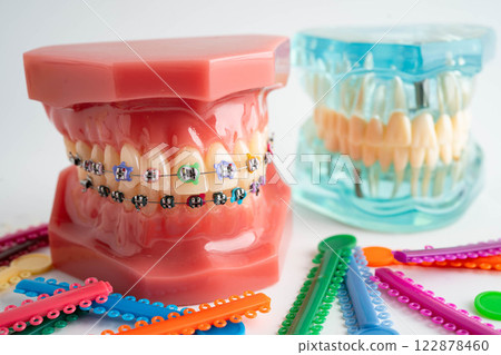 Orthodontic ligatures rings and ties, elastic rubber bands on orthodontic braces, model for dentist studying about dentistry. Orthodontic ligatures rings and ties, elastic rubber bands on orthodontic braces, model for dentist studying about dentistry. 122878460