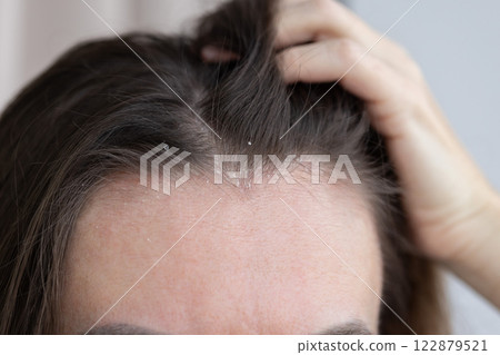 Closeup woman hair with dandruff. 122879521