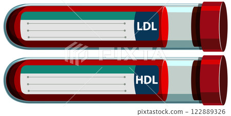 Cholesterol Blood Test Tubes Illustration Cholesterol Blood Test Tubes Illustration 122889326