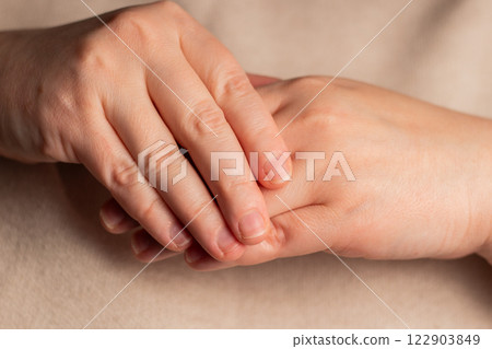 Closeup image of fingers and nails bitten. Health and medical concept. Manicure artist. Image for before and after. 122903849