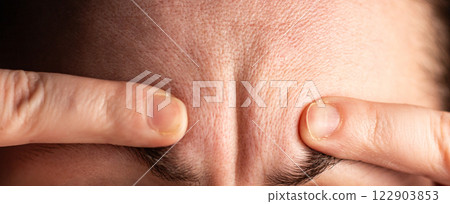 Woman demonstrating wrinkles on forehead. Ageism concept. Natural skin with wrinkles. Image for cosmetologist and face injections topics. 122903853