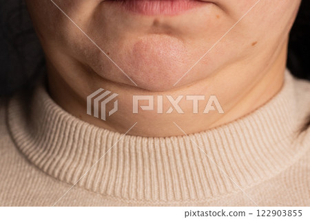 Closeup of woman second chin. Overweight problem. Facial line correction concept. 122903855