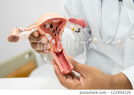 Uterus, doctor with anatomy model for study diagnosis and treatment in hospital. 122904126