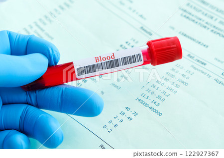 Complete blood samples and blood test results . Health and medical concepts 122927367