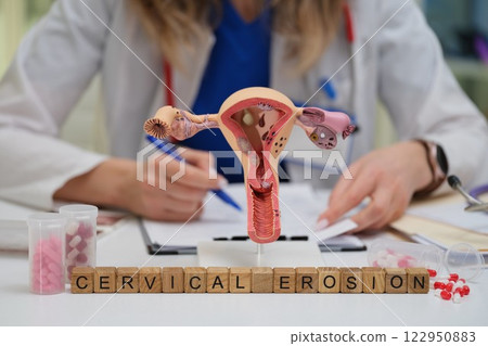 A Comprehensive Understanding of Cervical Erosion Medical Insights and Educational Resources A Comprehensive Understanding of Cervical Erosion Medical Insights and Educational Resources 122950883