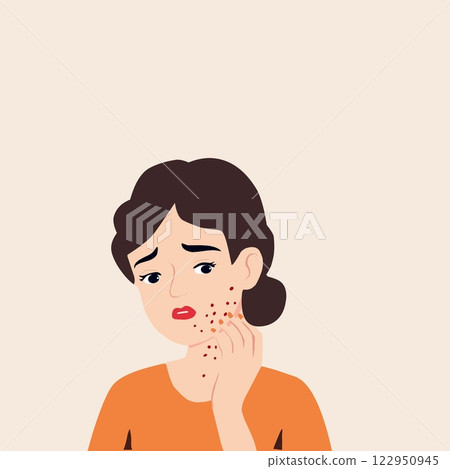 Illustration of a worried woman with acne on her face, touching her cheek. Concept of skin problems, dermatology, acne treatment, and skincare in a modern flat design style Illustration of a worried woman with acne on her face, touching her cheek. Concept of skin problems, dermatology, acne treatment, and skincare in a modern flat design style 122950945