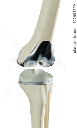 bone, anatomy, knee 122995809