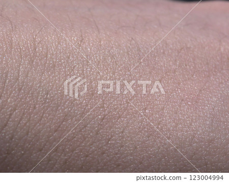 皮膚照片 123004994