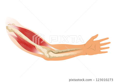Arm muscle biceps with skeleton. Muscle tension of human hand on white background. Bones and joints in male silhouette. Medical vector illustration of hand for clinic or hospital Arm muscle biceps with skeleton. Muscle tension of human hand on white background. Bones and joints in male silhouette. Medical vector illustration of hand for clinic or hospital 123010273