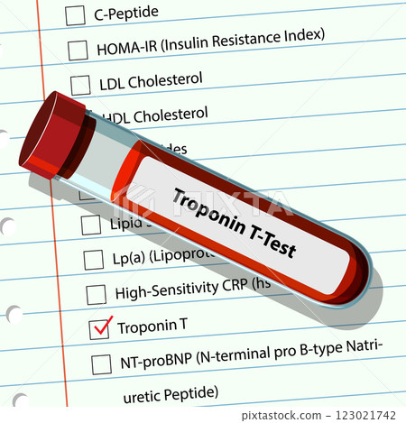 Medical Blood Test Illustration 123021742