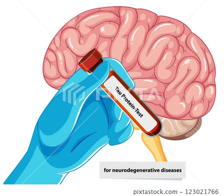 Tau Protein Test for Brain Health Tau Protein Test for Brain Health 123021766