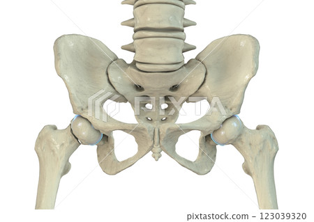 Subcapital femur fracture, 3D illustration 123039320