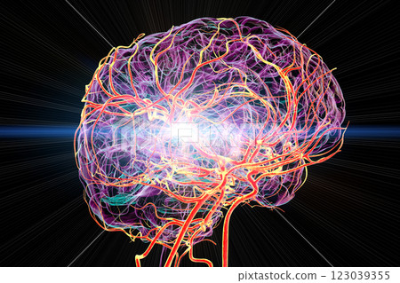 Brain stroke, conceptual 3D illustration 123039355