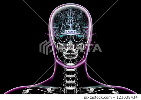Atrophic substantia nigra in Parkinson's disease, 3D illustration 123039434