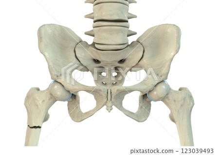 Subtrochanteric femur fracture, 3D illustration 123039493
