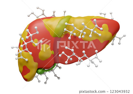 3d fatty liver disease with glucose molecule isolated. 3d illustration render 123043932