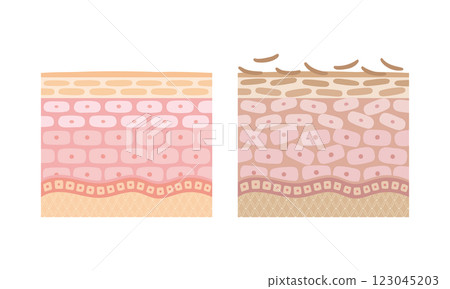 Comparison illustration of healthy and unhealthy skin 123045203