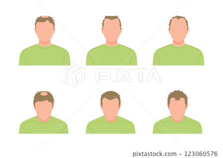 一組簡單的圖標，從正面看，一個頭髮稀疏的男人 123060576