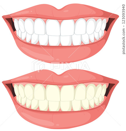 Comparison of Healthy and Unhealthy Teeth Comparison of Healthy and Unhealthy Teeth 123093940