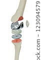 bone, knee, leg 123094579