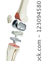 bone, knee, leg 123094580