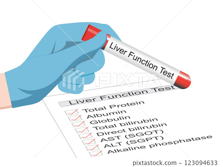 Liver function tests are blood tests. 123094633