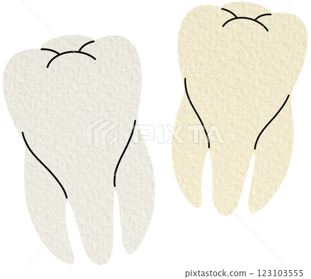 Teeth in different stages of color change development. Flat cartoon vector illustration isolated on background. Dental hygiene, whitening, and treatment concept. Teeth in different stages of color change development. Flat cartoon vector illustration isolated on background. Dental hygiene, whitening, and treatment concept. 123103555