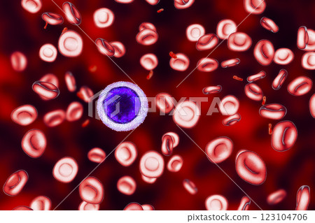 Iron deficiency anemia Iron deficiency anemia 123104706