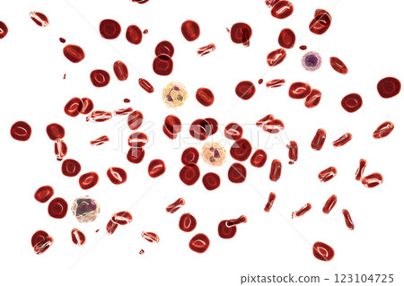 Normal blood smear Normal blood smear 123104725