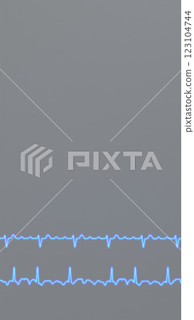ECG graphs of regular and irregular atrial flutter 123104744