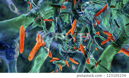 Mycobacterium tuberculosis bacteria, the causative agent of tuberculosis, 3D illustration. M. tuberculosis and non-tuberculosis mycobacteria, M. leprae, M. avium complex, M. chelonae and other 123105234
