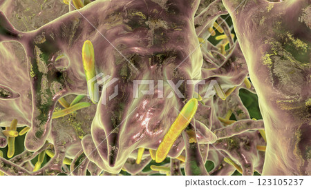 Mycobacterium tuberculosis bacteria, the causative agent of tuberculosis, 3D illustration. M. tuberculosis and non-tuberculosis mycobacteria, M. leprae, M. avium complex, M. chelonae and other 123105237