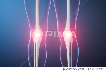 injured, ache, disease 123120794