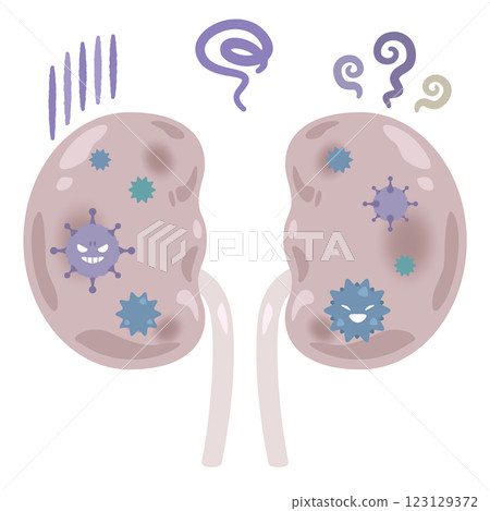 Illustration of a kidney infected with bacteria 2 123129372