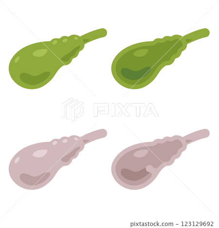 Illustration of a healthy and clean gallbladder and an unhealthy gallbladder Illustration of a healthy and clean gallbladder and an unhealthy gallbladder 123129692