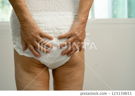Asian senior woman patient wearing incontinence diaper in hospital, healthy strong medical. Asian senior woman patient wearing incontinence diaper in hospital, healthy strong medical. 123139651