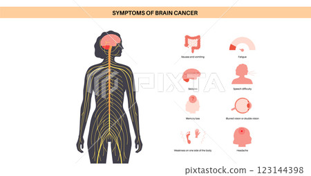Primary brain tumors 123144398