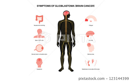 Primary brain tumors 123144399