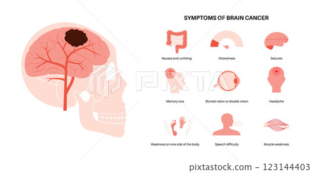 Primary brain tumors 123144403