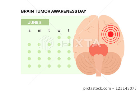 Brain Tumor Awareness Day Brain Tumor Awareness Day 123145073