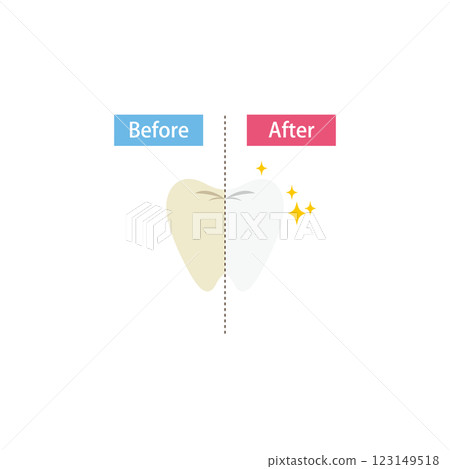 牙齒美白前後對比圖 牙齒美白前後對比圖 123149518