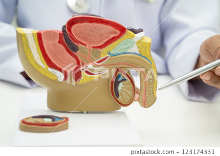 Male reproductive system, Asian doctor holding human anatomy model for study diagnosis and treatment in hospital. 123174331