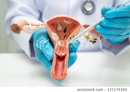 Uterus, doctor holding human anatomy model for study diagnosis and treatment in hospital. 123174369
