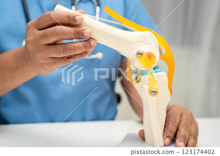 Asian doctor holding spinal nerve and bone model, Lumbar spine displaced herniated disc fragment for treatment medical in the orthopedic department. 123174402