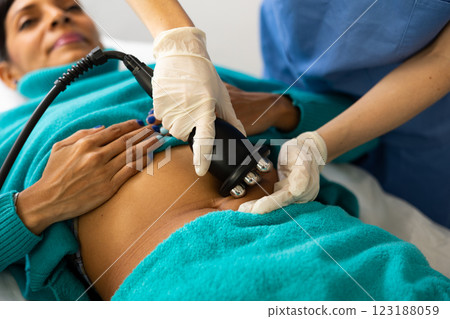 Ultrasound cavitation body procedure 123188059