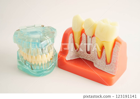 Dental teeth model on white background for learn about dentistry. Dental teeth model on white background for learn about dentistry. 123191141