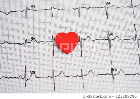 Red heart on Electrocardiogram paper to test check the heartbeat. 123199796