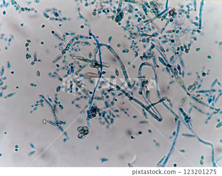 Mold spore staining 123201275
